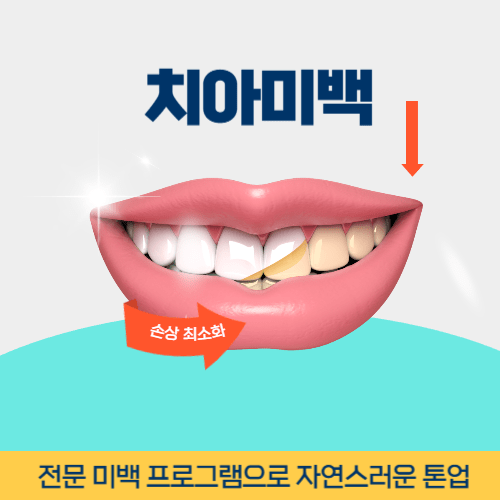 충주치과 충주시 치과 치아미백